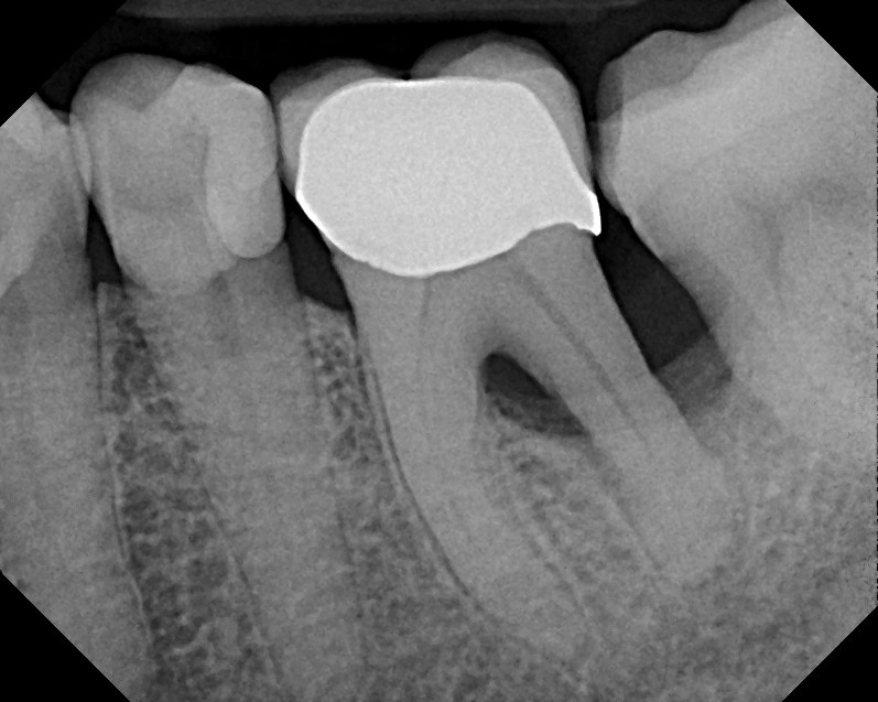 دندان درد و دندان قروچه