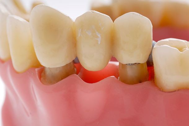 اقدامات دندانپزشکی