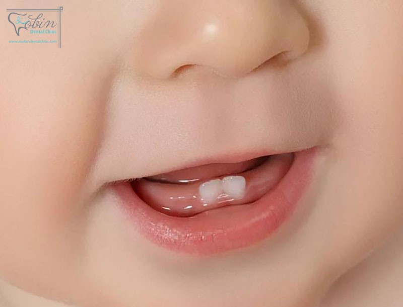 دندان های جلوی پایین نوزادان