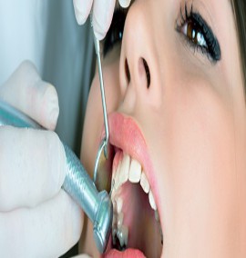 پر کردن دندان با کامپوزیت و مواد سفید