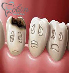 چگونه از کرم خوردگی دندان جلوگیری کنیم؟