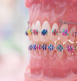 بهترین سن برای ارتودنسی دندان چیست؟