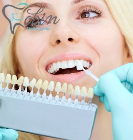 معرفی خدمات بلیچینگ دندان