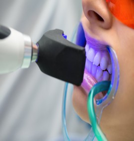 بلیچینگ دندان چیست؟ مزایا و معایب بلیچینگ و مراقبت های بعد از بلیچینگ