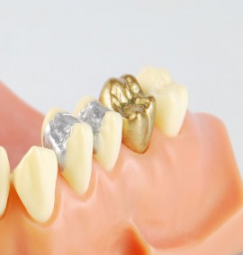 ترمیم دندان چیست؟ معرفی انواع روش ها